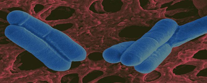 <br>The community of beneficial bacteria that live in our intestines, known as the gut microbiome, are important for the development and function of the immune system. There has .... <a href=' http://www.caltech.edu/news/when-beneficial-bacteria-knock-no-one-home-50659' target='_blank'>More</a>